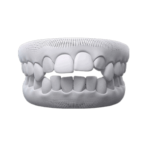 Tooth pain diagram