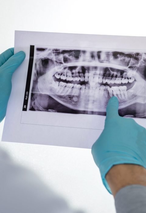 Image of male doctor or dentist holding and looking at dental x-ray.